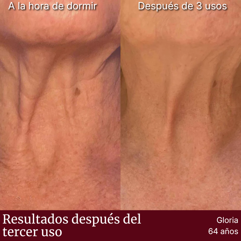 Placa Dermaplac®  — Silicona Médica Antiarrugas