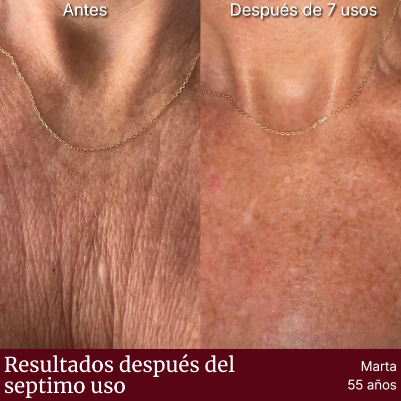 Placa Dermaplac®  — Silicona Médica Antiarrugas