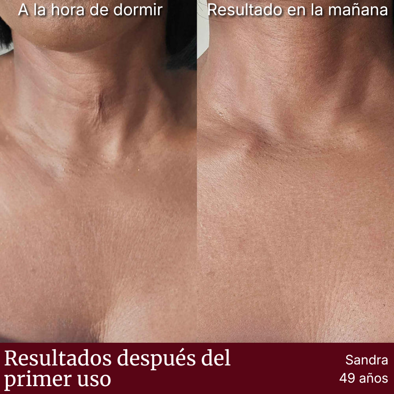 Placa Dermaplac®  — Silicona Médica Antiarrugas